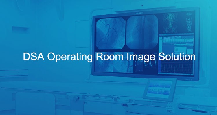 DSA Operating Room Image Solution