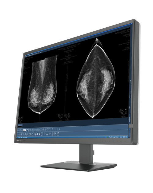 Ultrasound of Breast – Beacon Health Screening Centre